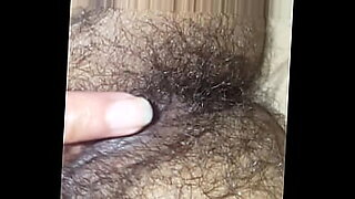 what-to-put-on-a-burn-on-finger