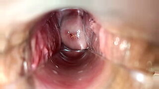 cum-in-anal-speculum-xhamster